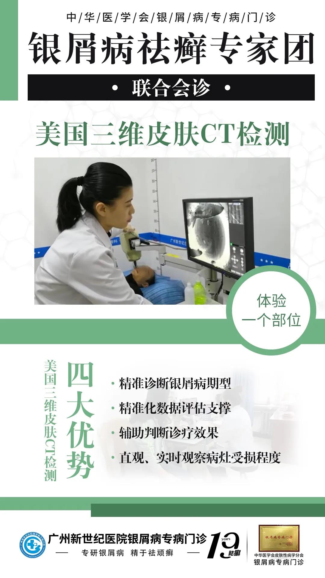 银屑病袪癣专家团联合会诊